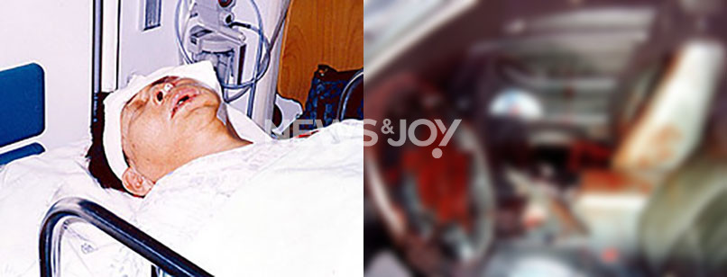2003년 10월 29일 김도형 교수의 아버지는 JMS 신도들에게 무차별 폭행을 당해, 왼쪽 얼굴뼈가 함몰되는 중상을 입었다(사진 왼쪽). 사건 당시 김 교수 아버지가 타고 있던 차 내부는 피바다가 됐다(사진 오른쪽). 뉴스앤조이 자료 사진